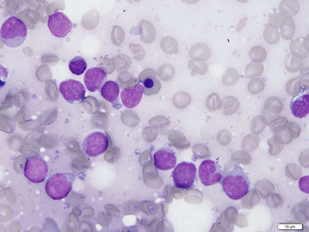 Figure 8 Diagnostic Aspirate 100x